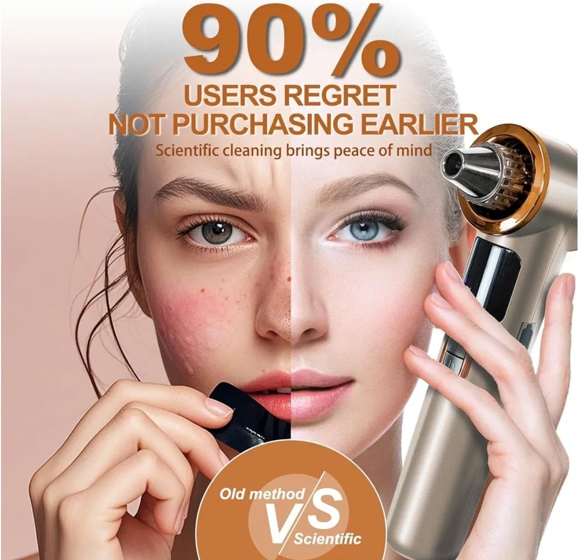 Aspiradora para eliminar puntos negros