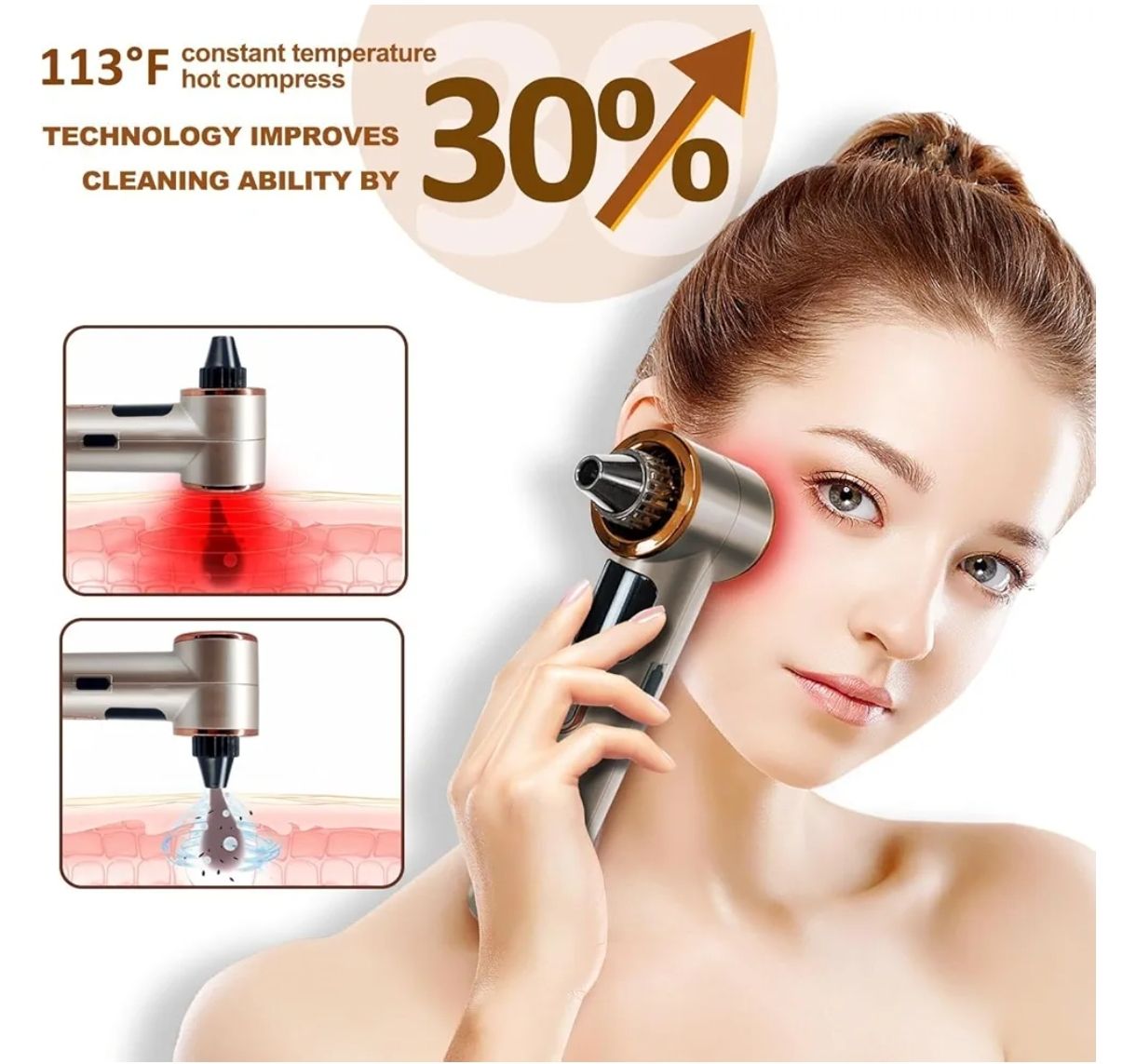 Aspiradora para eliminar puntos negros