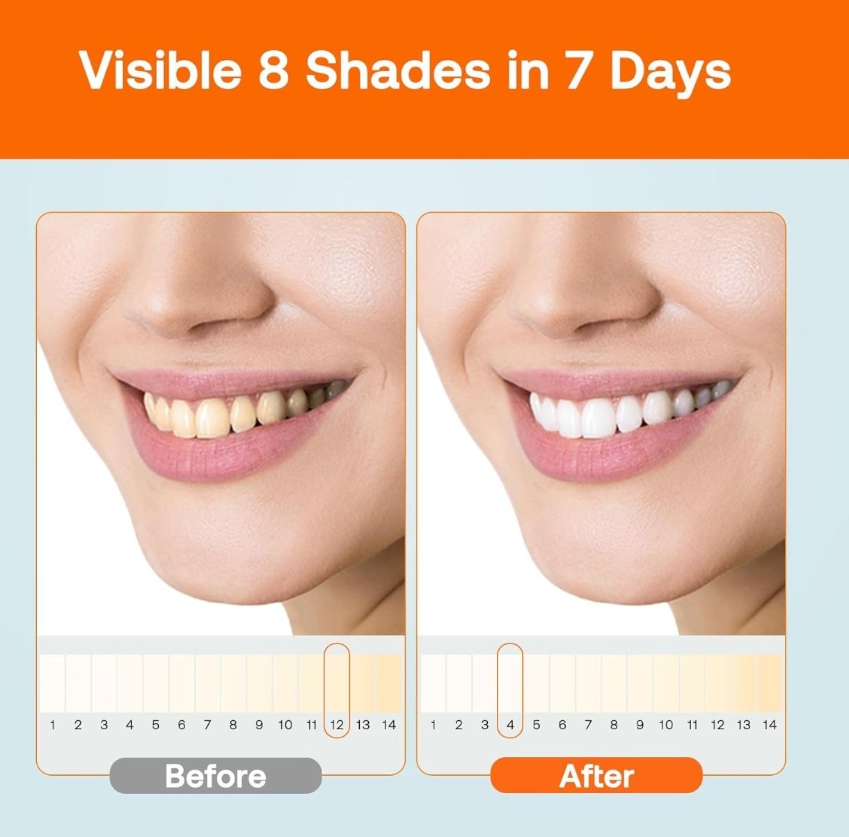 Bitvae Kit De Blanqueamiento Dental